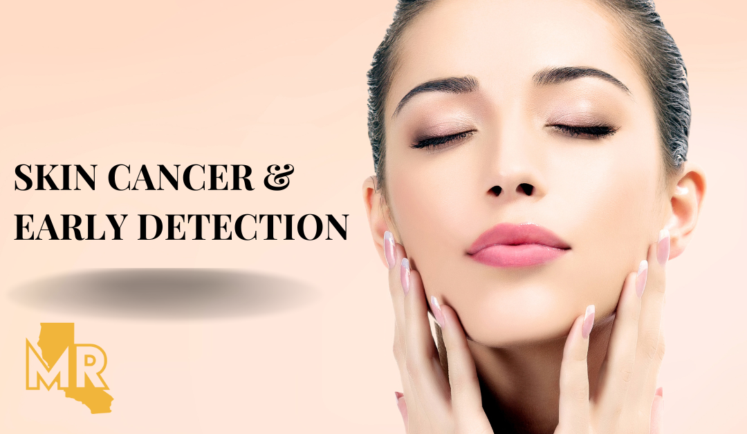 Skin Cancer & Early Detection